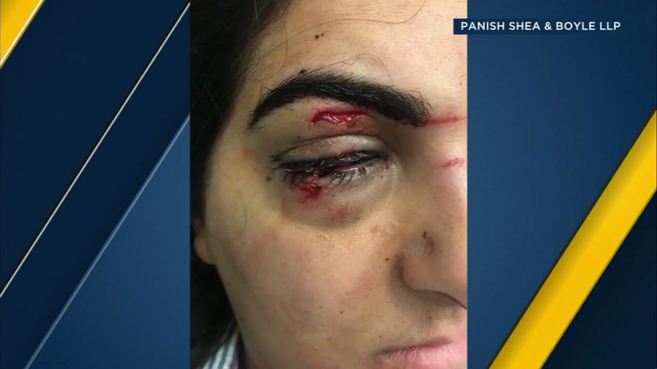 Woman sues Las Vegas bar over injuries from mechanical penis ride